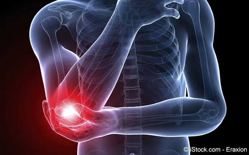 Az Arthritis And Rheumatology Locations