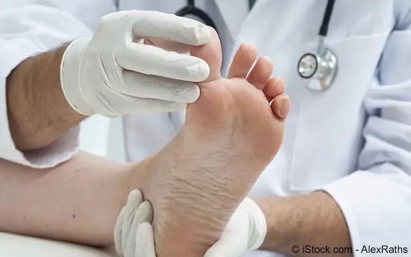 Eingewachsener Nagel