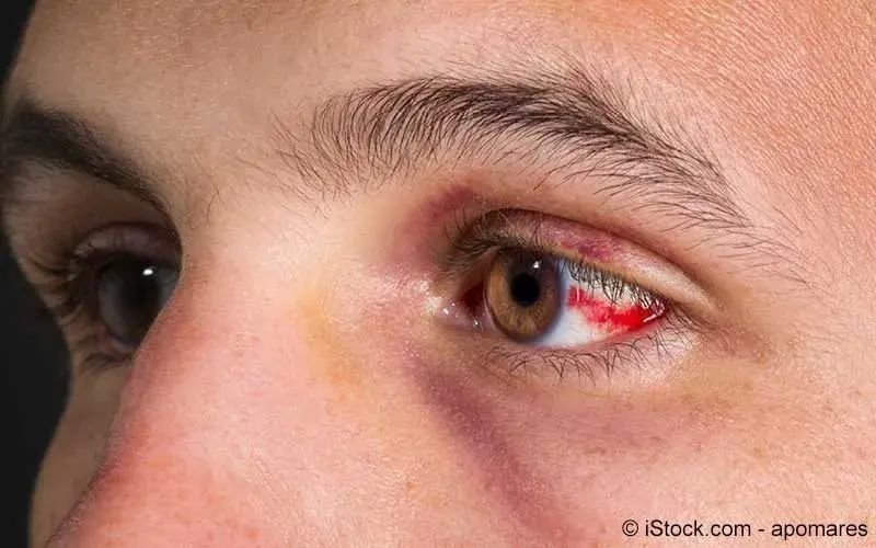 Hämatom bilder im kopf lyrics