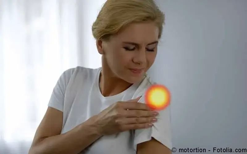 Impingement-Syndrom (Schulterschmerzen)