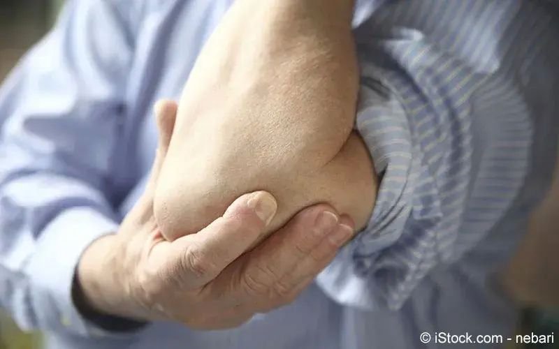 Luxation (Verrenkung)