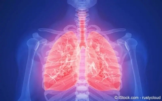 Cor Pulmonale (Lungenherz)