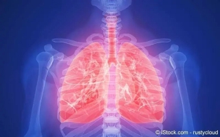 Lungenentzündung (Pneumonie)