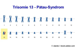Trisomie 13 (Pätau-Syndrom)